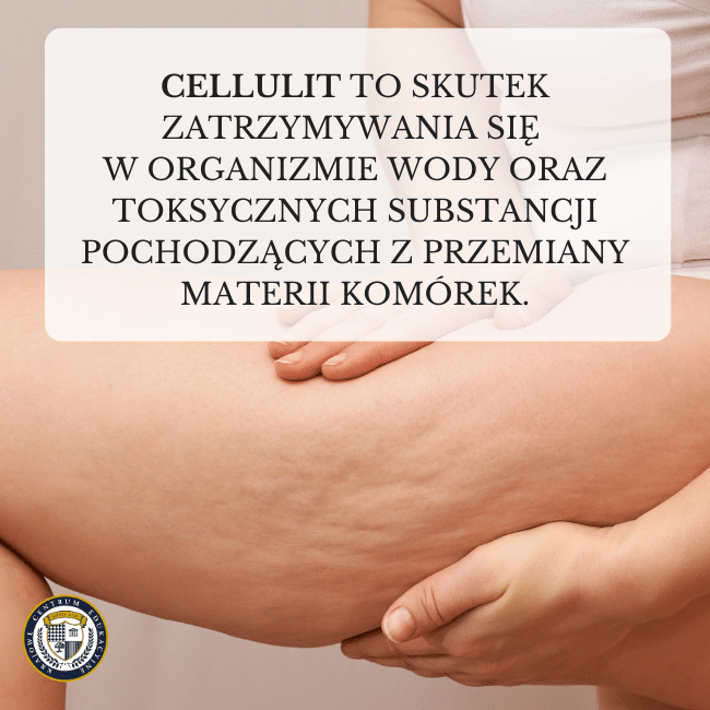 Napis w białym polu wyjaśniający, że cellulit jest skutkiem zatrzymywania się w organizmie wody oraz toksycznych substancji